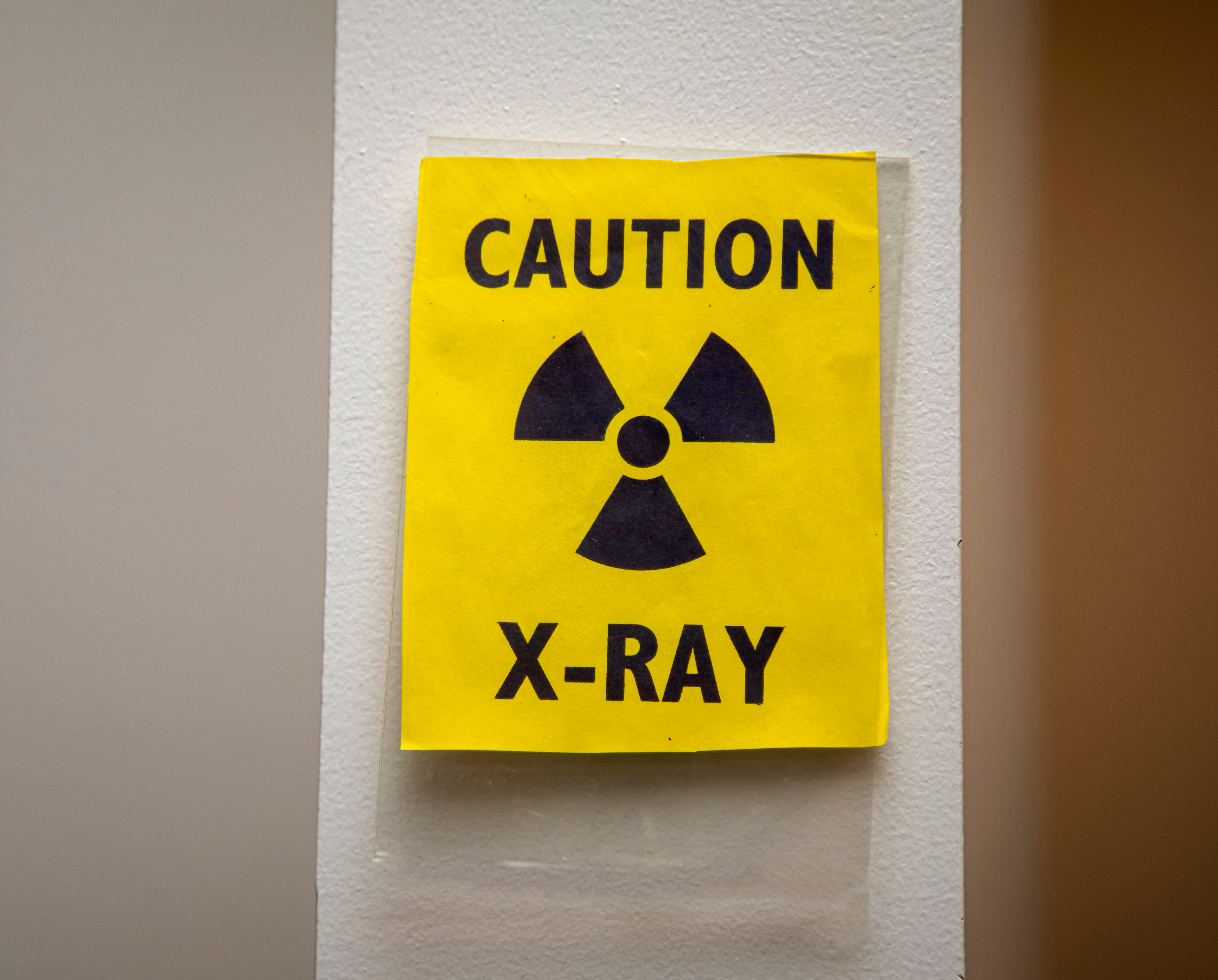 Example of x-ray caution signage